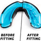 Mouth Guard Sports W/Case, Professional Mouthguard for Boxing, Football, Hockey, Jiu Jitsu, Muay Thai, MMA, Wrestling and High Contact Sports, Fits Adults, Youth, Kids 11+ (Black/Blue)