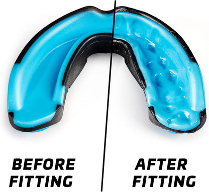 Mouth Guard Sports W/Case, Professional Mouthguard for Boxing, Football, Hockey, Jiu Jitsu, Muay Thai, MMA, Wrestling and High Contact Sports, Fits Adults, Youth, Kids 11+ (Black/Blue)